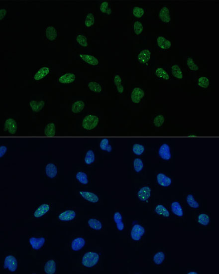 Anti-MKL1 Polyclonal Antibody (CAB8504)