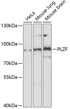 Anti-PLZF Antibody (CAB5863)