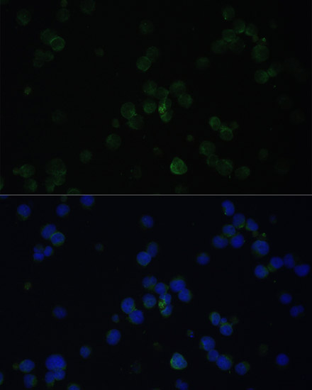 Anti-CD3D Antibody (CAB1238)