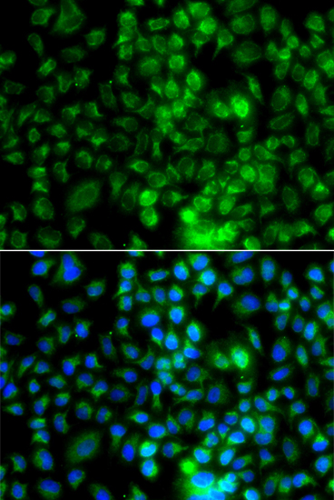 Anti-EPHA1 Antibody (CAB13301)