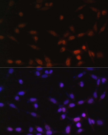 Anti-ZEB2 Antibody (CAB5705)