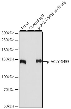 Anti-Phospho-ACLY-S455 pAb (CABP0779)