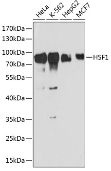 Anti-HSF1 Antibody (CAB13765)