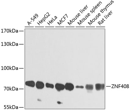 Anti-ZNF408 Polyclonal Antibody (CAB8512)