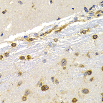 Anti-EEF1D Antibody (CAB2509)