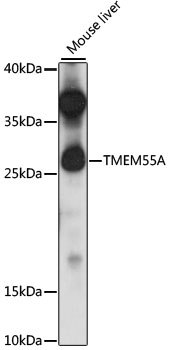 Anti-TMEM55A Antibody (CAB15471)