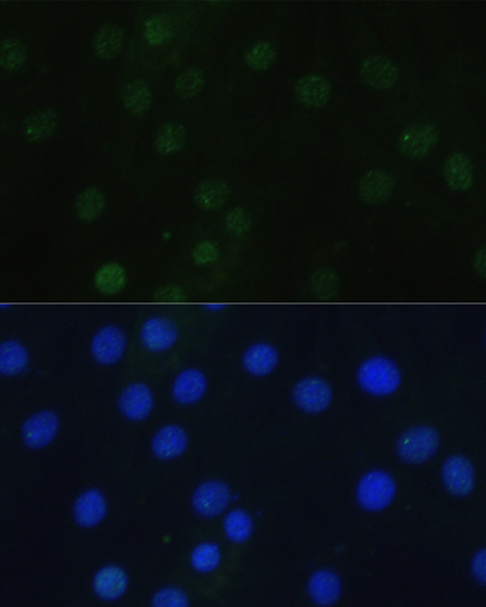 Anti-Phospho-Histone H3-S28 pAb (CABP0839)