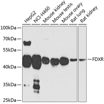 Anti-FDXR Antibody (CAB3860)