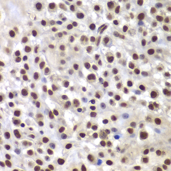 Anti-SMARCB1 Antibody [KO Validated] (CAB5767)