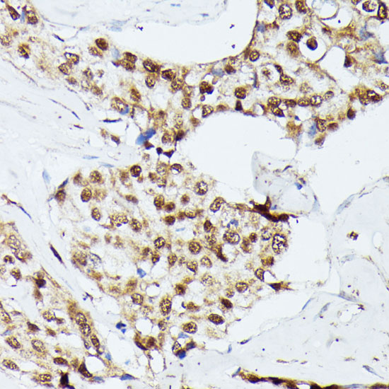 Anti-KIF22 Antibody (CAB15285)