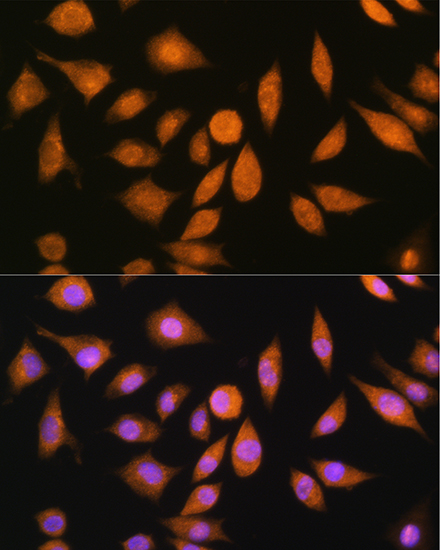 Anti-SREBP2 Antibody (CAB13049)