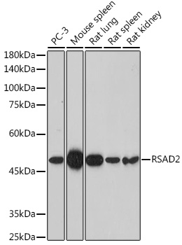 Anti-RSAD2 Polyclonal Antibody (CAB8271)