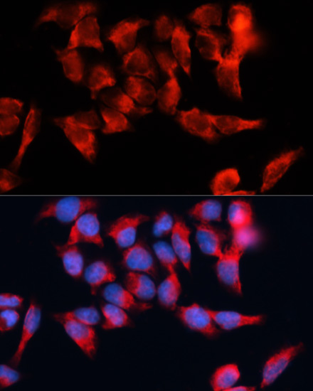 Anti-BST2 Antibody (CAB12315)