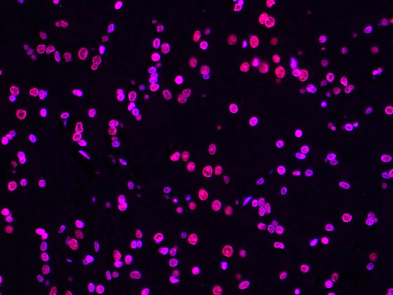 Paraffin embedded rat brain was treated with DNase I to fragment the DNA. DNA strand breaks showed intense fluorescent staining in DNase I treated sample (red). The cells were counterstained with DAPI (blue).