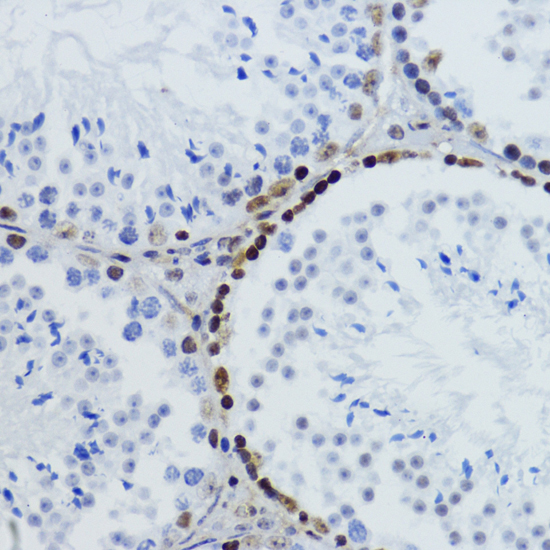 Anti-Acetyl-Histone H2B-K12 Antibody (CAB15619)