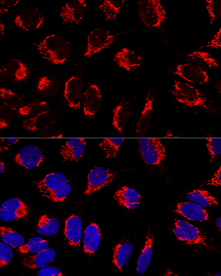 Anti-IMMT Antibody (CAB2751)