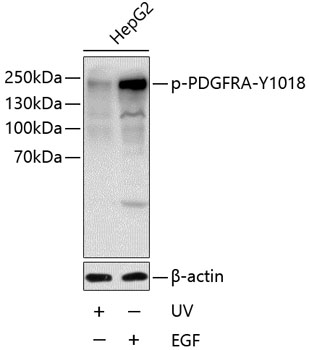 Anti-Phospho-PDGFRA-Y1018 Antibody (CABP0615)