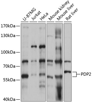 Anti-PDP2 Antibody (CAB14416)