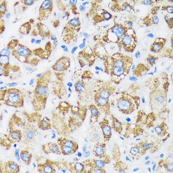 Anti-GTPBP8 Antibody (CAB16189)