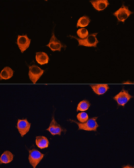 Anti-MFI2 Antibody (CAB6653)