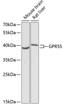 Anti-GPR55 Antibody (CAB12890)