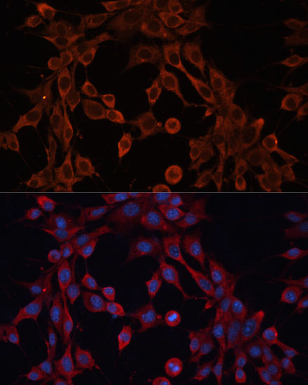 Anti-ABCA12 Antibody (CAB17680)