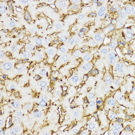 Anti-YKL-40 / CHI3L1 Antibody (CAB1723)