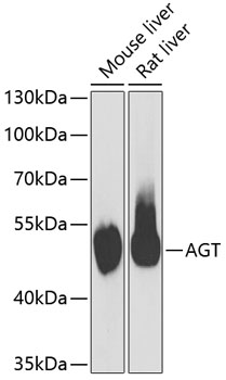 Anti-AGT Antibody (CAB6279)