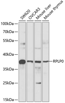 Anti-RPLP0 Antibody (CAB13633)