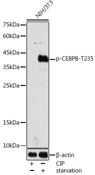 Anti-Phospho-CEBPB-T235 Antibody (CABP1055)