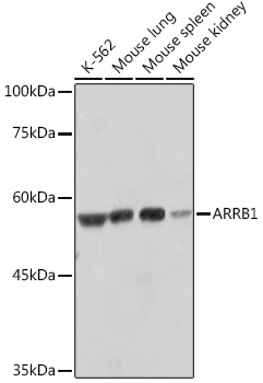 Anti-ARRB1 Antibody (CAB10742)