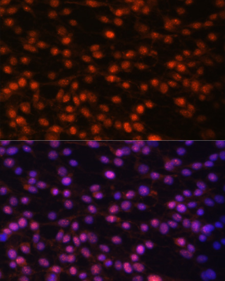 Anti-FOSL1 Antibody (CAB5372)