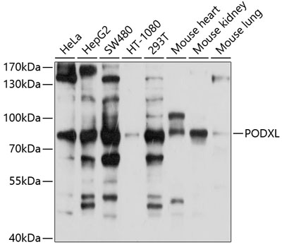 Anti-PODXL Antibody (CAB10200)