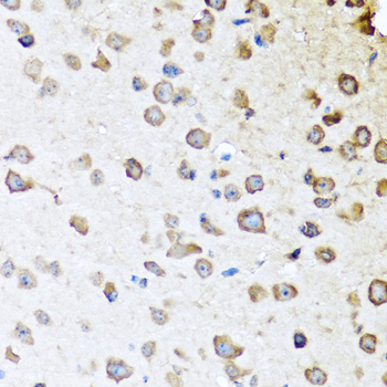 Anti-SERPINA10 Antibody (CAB7106)