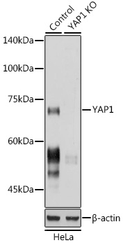 Anti-YAP1 Antibody [KO Validated] (CAB1002)