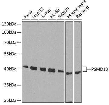 Anti-PSMD13 Antibody (CAB6956)