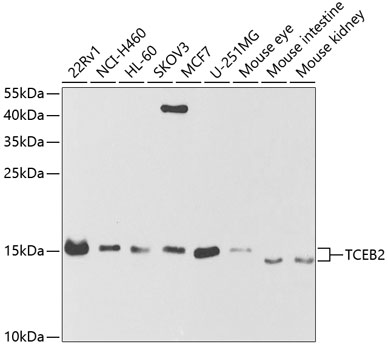 Anti-TCEB2 Antibody (CAB5362)