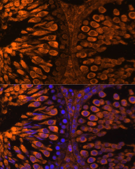 Anti-LDHC Antibody (CAB15003)