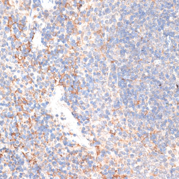 Anti-GPC3 Antibody (CAB13988)