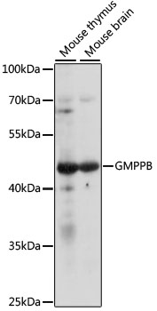 Anti-GMPPB Antibody (CAB16520)