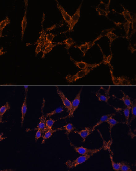 Anti-YWHAB Antibody (CAB1023)