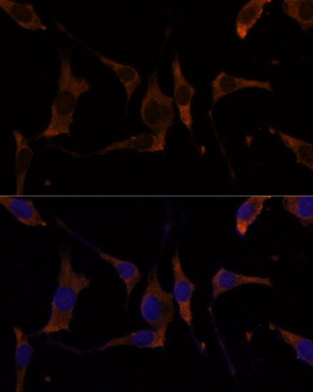 Anti-RPL7A Antibody (CAB13713)