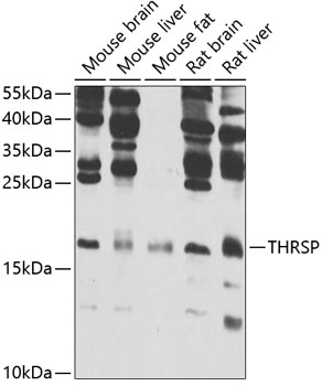 Anti-THRSP Antibody (CAB7232)