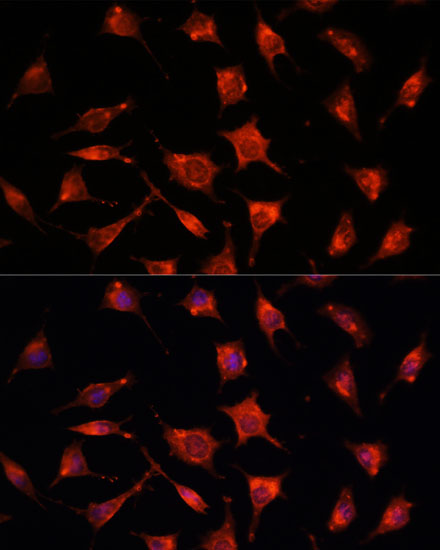 Anti-PEBP1 Antibody (CAB0578)