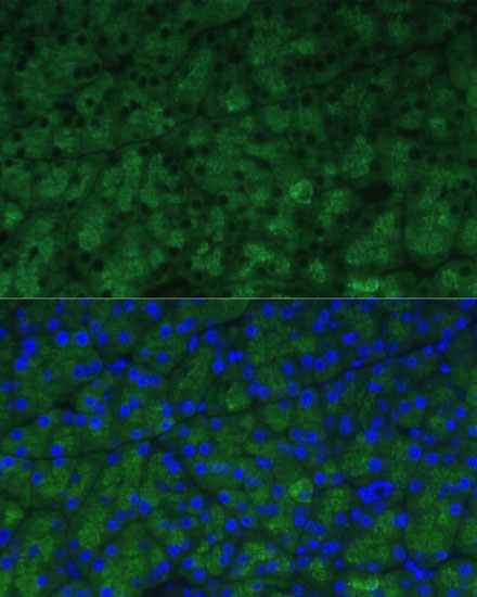 Anti-CTRB1 Antibody (CAB15043)