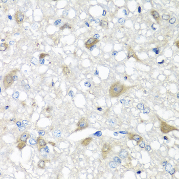 Anti-CCL11 Antibody (CAB7569)