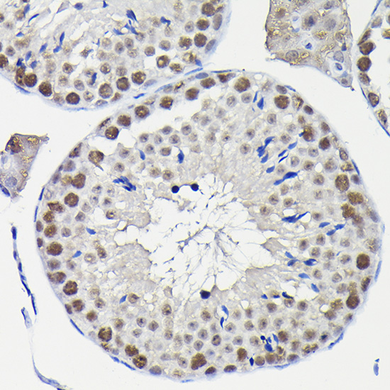 Anti-KPNA3 Polyclonal Antibody (CAB8347)