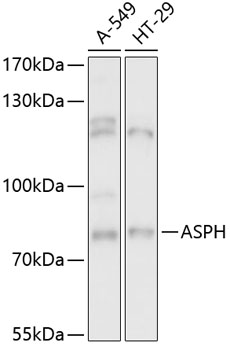 Anti-ASPH Antibody (CAB13153)