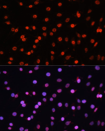 Anti-KLF2 Antibody (CAB16480)