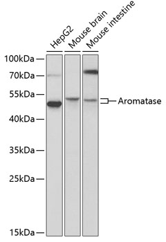 Anti-Aromatase Antibody (CAB2161)